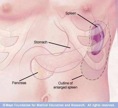 دول بعض صور الابدومن والبلفيس لسنه تانيه R7_enlargedspleen